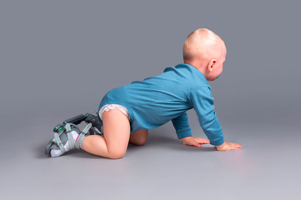 Как брейсы влияют на физическое развитие ребёнка? 