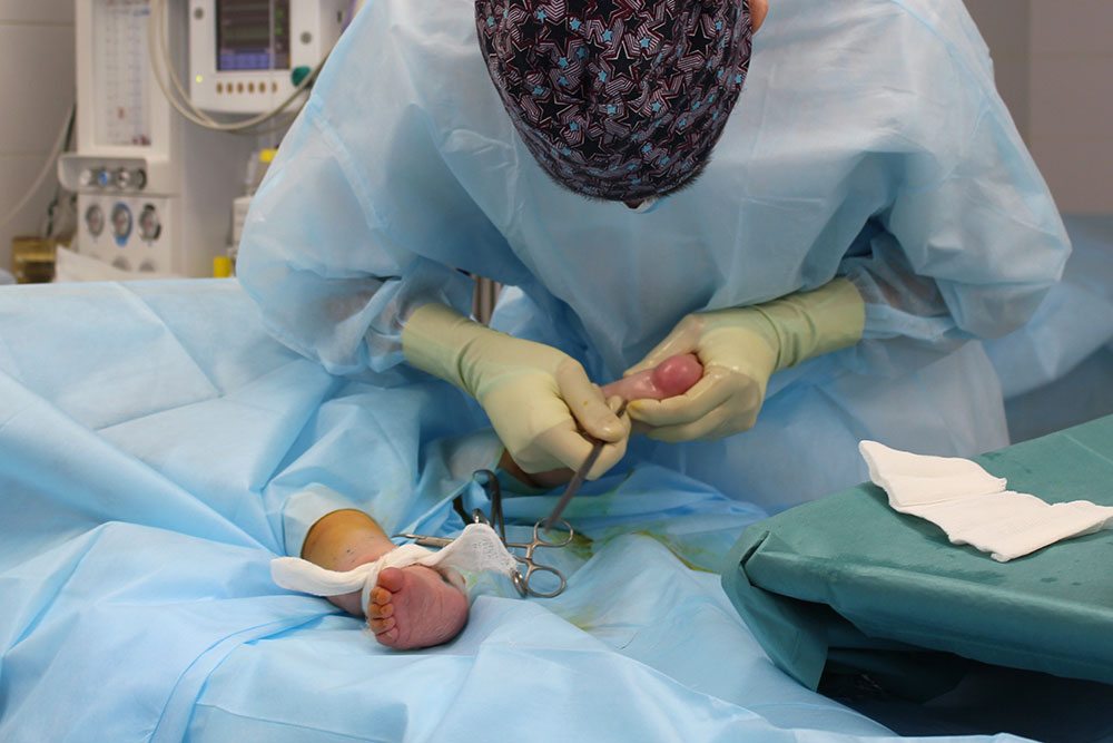 Ахиллотомия Ахиллотомия