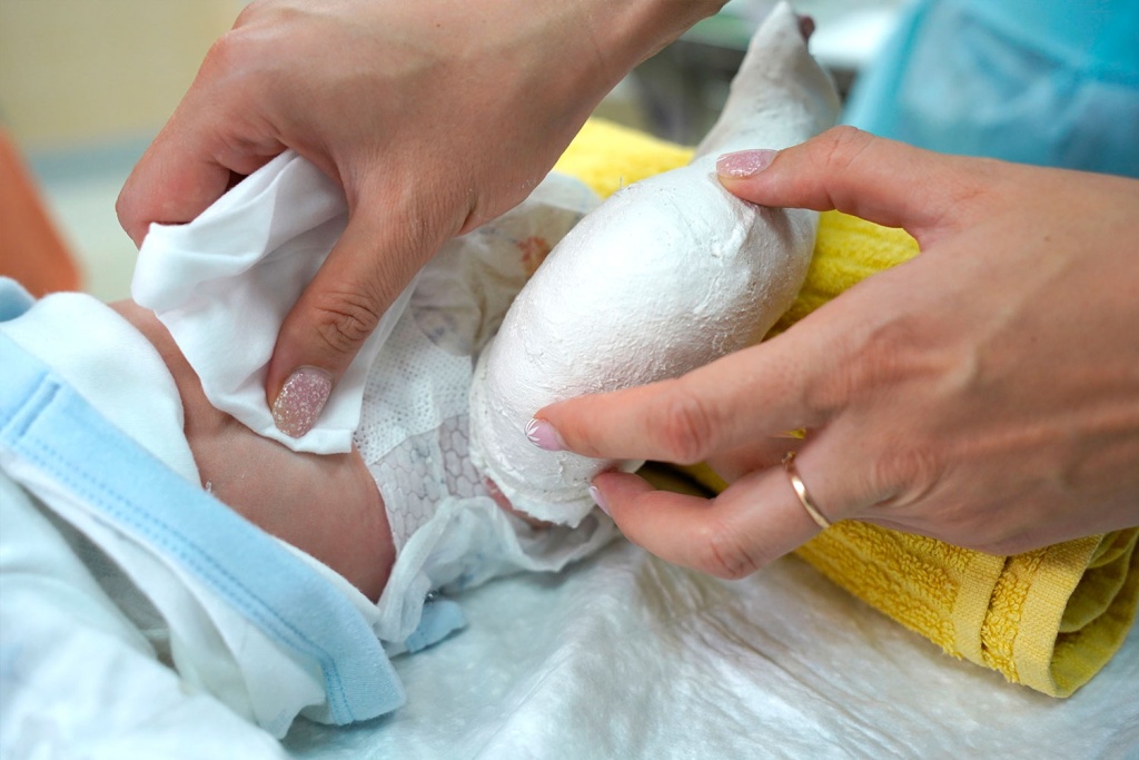 Уход-за-ребенком-в-гипсах.jpg