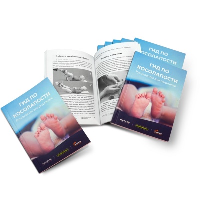 Гид по косолапости: руководство для родителей