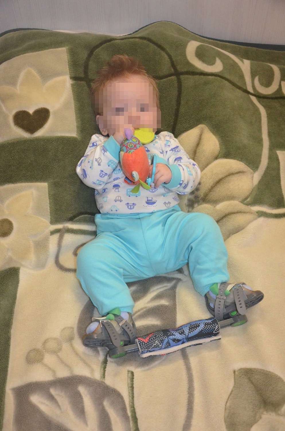 Ортопедические брейсы