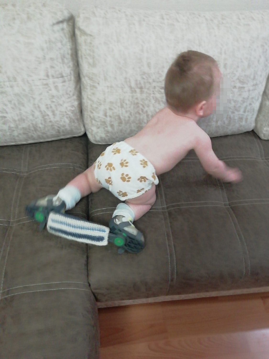 Брейсы с планкой