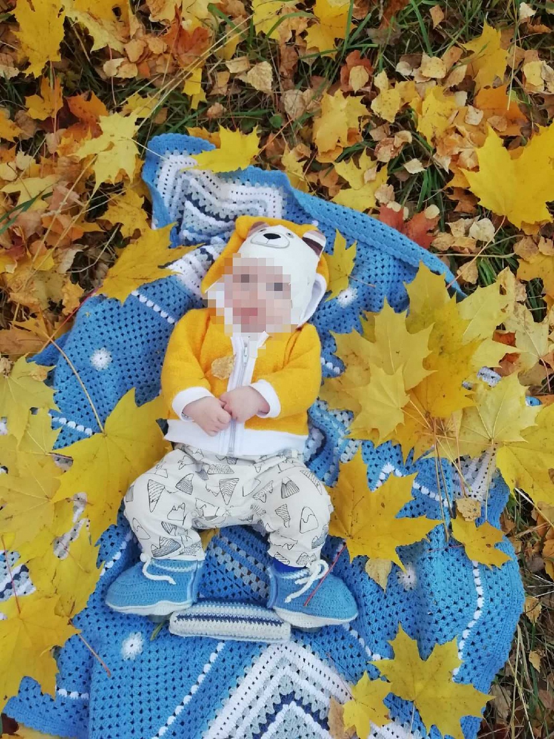 Брейсы при косолапости